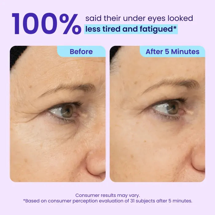 Claré Pure Eye Fix