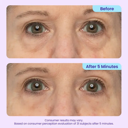 Claré Pure Eye Fix